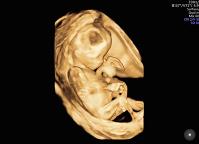 人造干细胞功能与作用价格,人工造干细胞可能吗