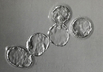 干细胞白色面膜,干细胞面膜敷多久