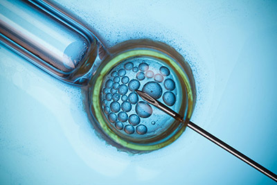 泰国试管冻胚移植流程
